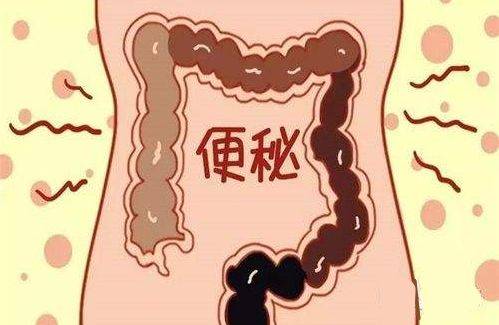大便超人下载安装_超人大便超人_大便超人