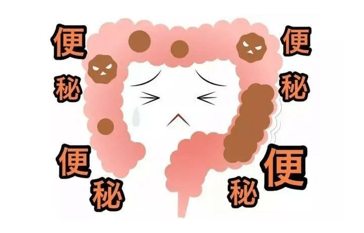 大便超人下载安装_超人大便超人_大便超人